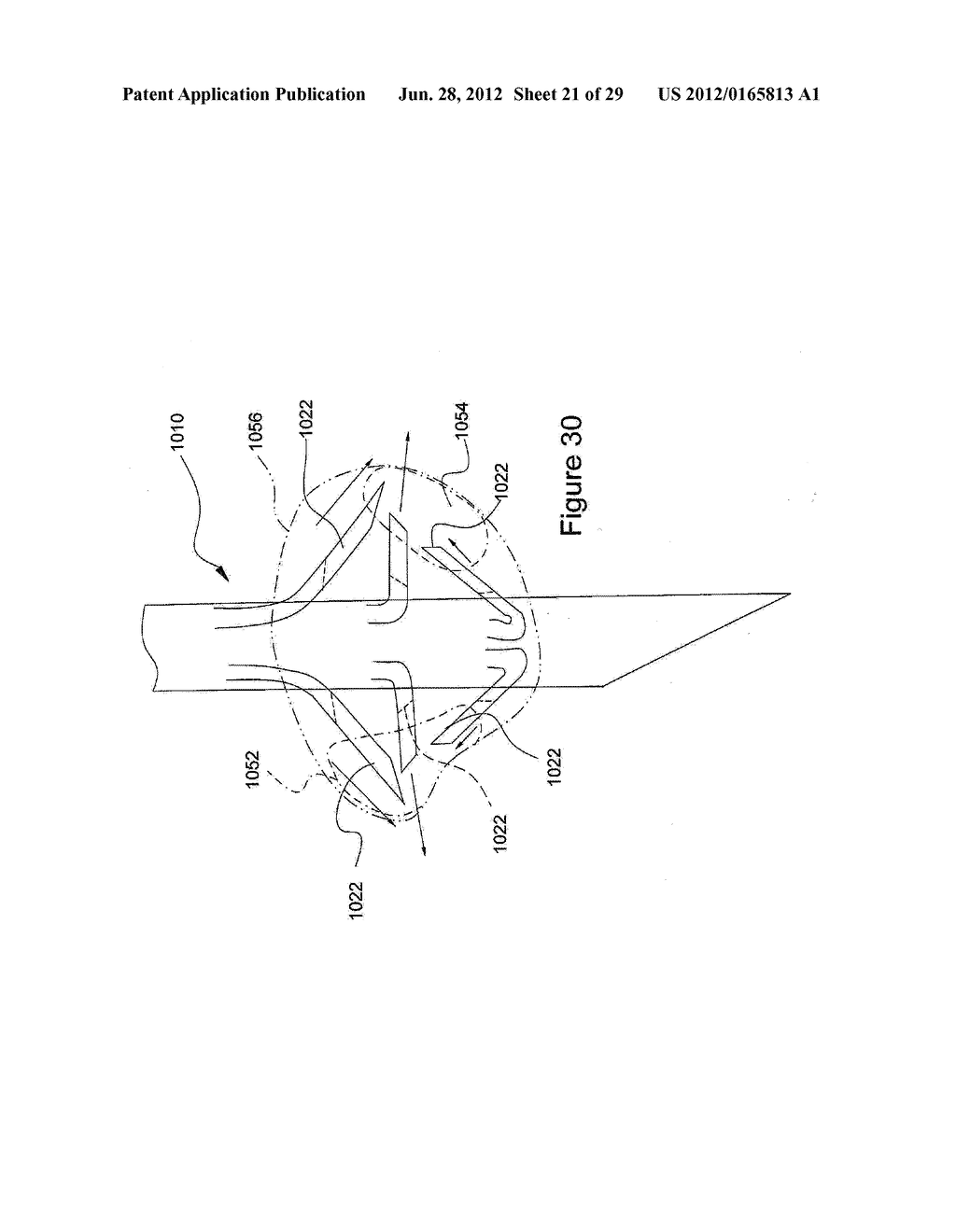 RADIO FREQUENCY ABLATION DEVICE FOR THE DESTRUCTION OF TISSUE MASSES - diagram, schematic, and image 22