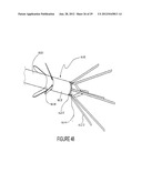 RADIO FREQUENCY ABLATION DEVICE FOR THE DESTRUCTION OF TISSUE MASSES diagram and image