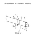 RADIO FREQUENCY ABLATION DEVICE FOR THE DESTRUCTION OF TISSUE MASSES diagram and image