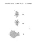 SURGICAL GUIDING TOOL, METHODS FOR MANUFACTURE AND USES THEREOF diagram and image