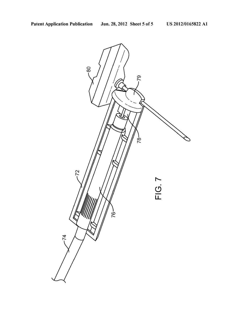 Use of Vibration in Composite Fixation - diagram, schematic, and image 06