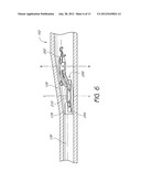 INJECTOR FOR INTRAOCULAR LENS SYSTEM diagram and image