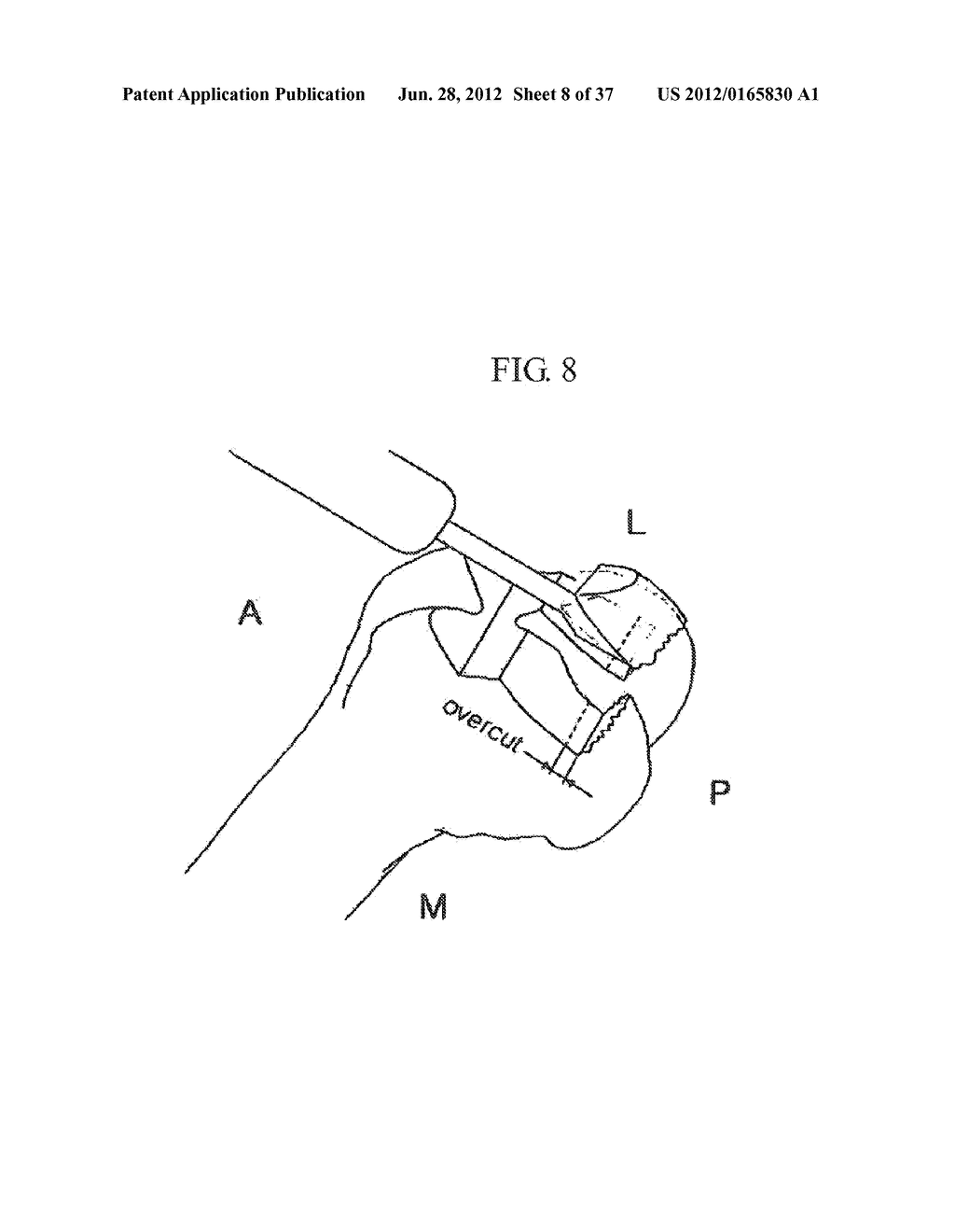 METHOD AND SYSTEM FOR CUTTING KNEE JOINT USING ROBOT - diagram, schematic, and image 09