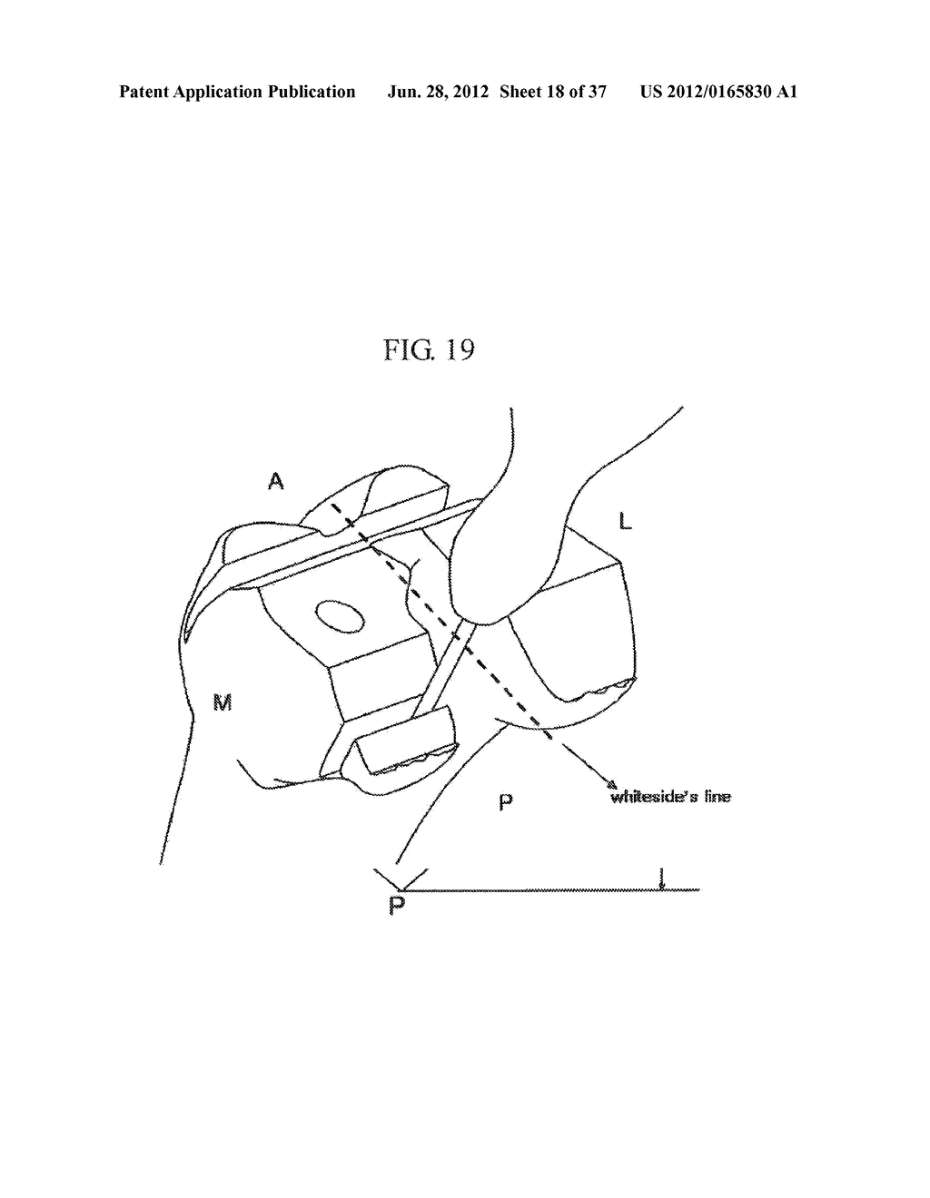 METHOD AND SYSTEM FOR CUTTING KNEE JOINT USING ROBOT - diagram, schematic, and image 19