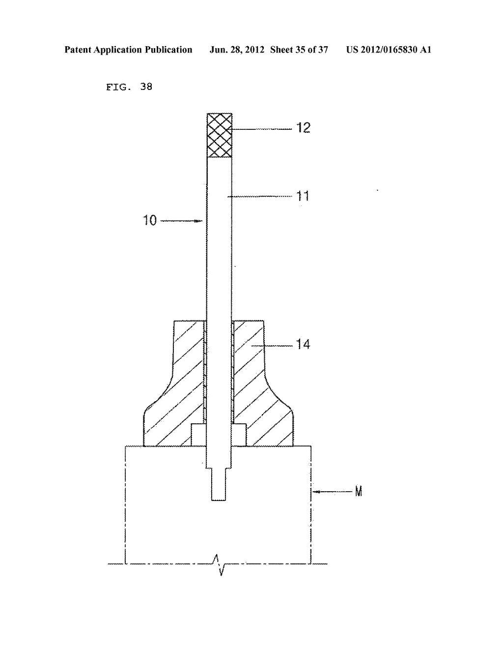 METHOD AND SYSTEM FOR CUTTING KNEE JOINT USING ROBOT - diagram, schematic, and image 36