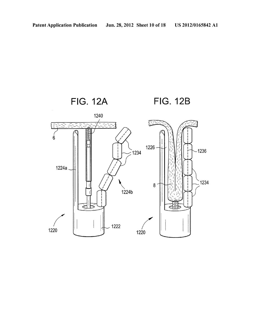 ENDOLUMINAL FOLD CREATION - diagram, schematic, and image 11