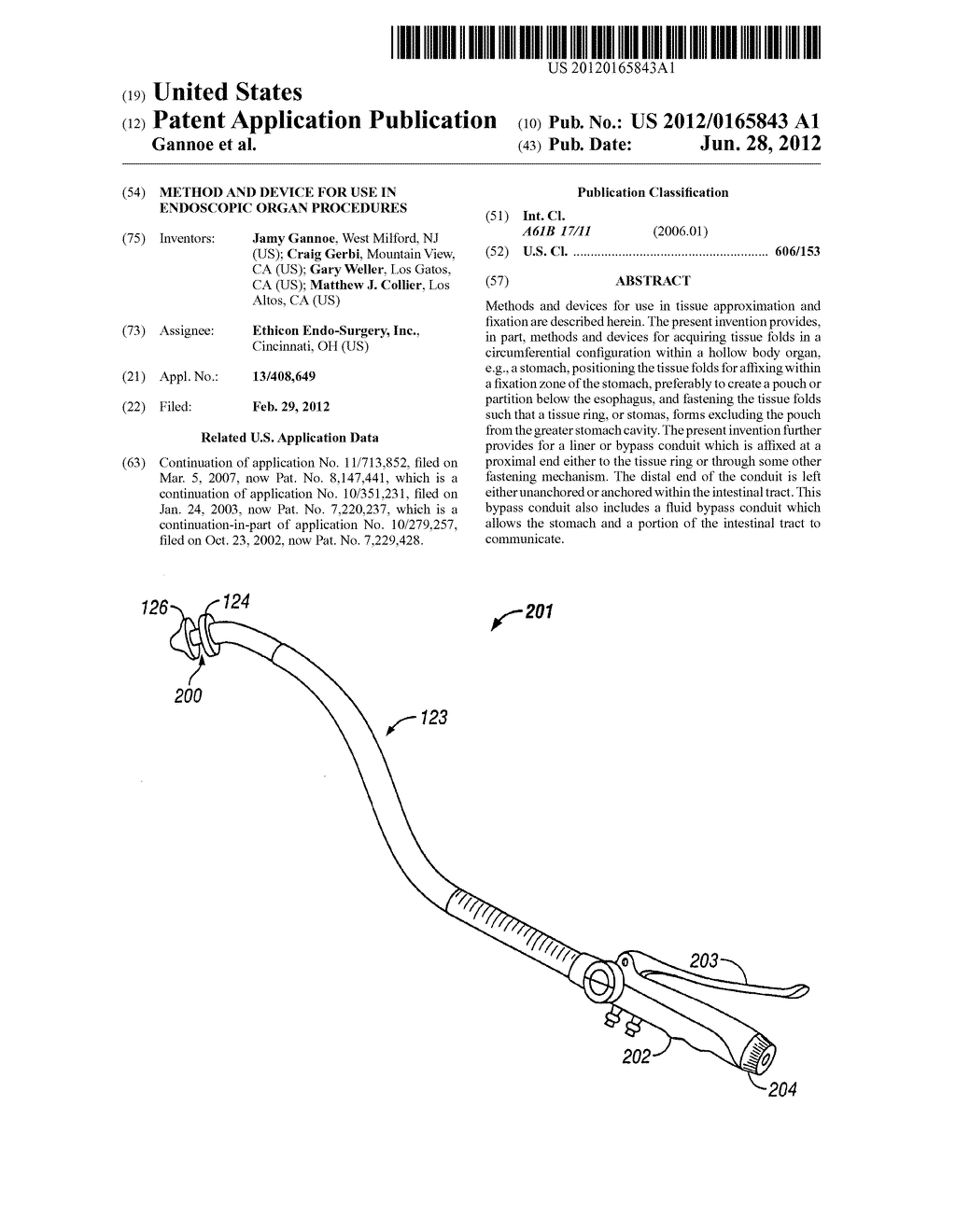 METHOD AND DEVICE FOR USE IN ENDOSCOPIC ORGAN PROCEDURES - diagram, schematic, and image 01