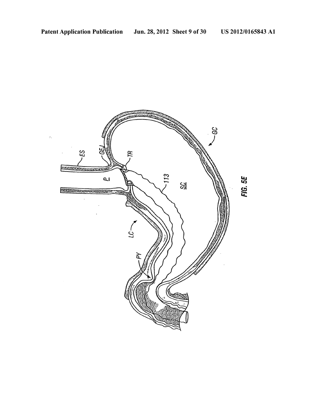 METHOD AND DEVICE FOR USE IN ENDOSCOPIC ORGAN PROCEDURES - diagram, schematic, and image 10