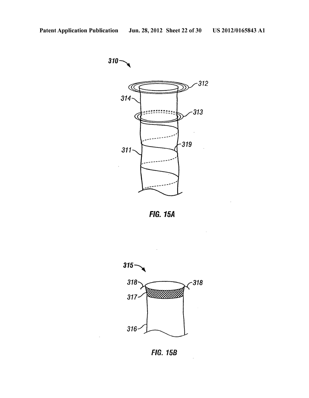 METHOD AND DEVICE FOR USE IN ENDOSCOPIC ORGAN PROCEDURES - diagram, schematic, and image 23