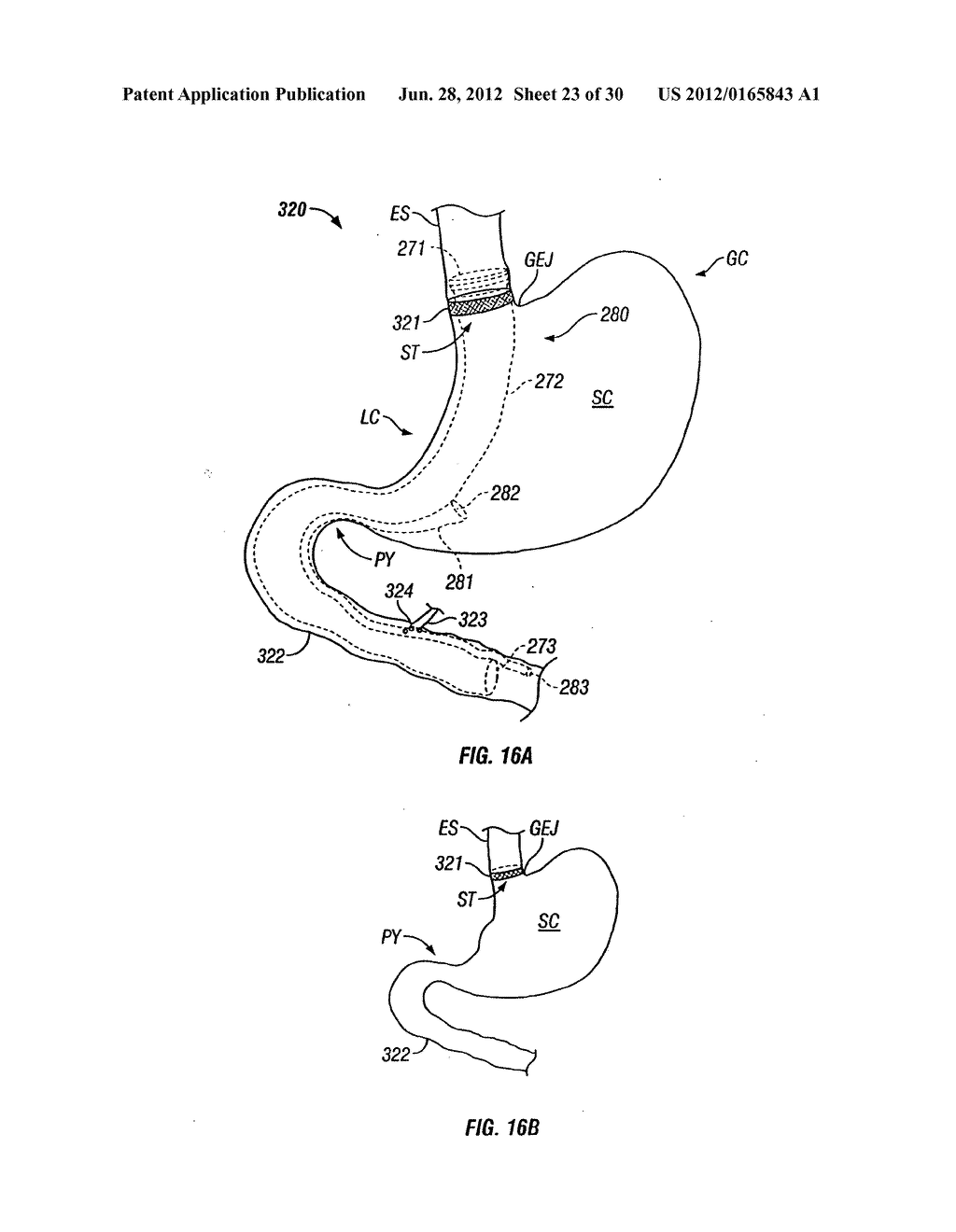 METHOD AND DEVICE FOR USE IN ENDOSCOPIC ORGAN PROCEDURES - diagram, schematic, and image 24