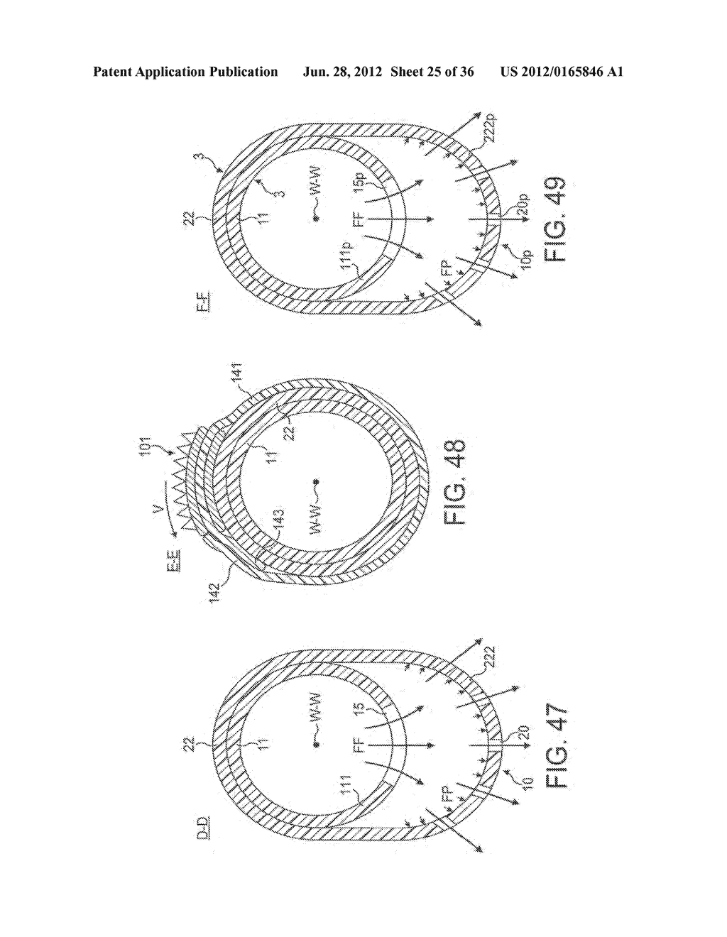 Rotational Device with Inflatable Support Elements and Torque Transmitting     Membrane - diagram, schematic, and image 26