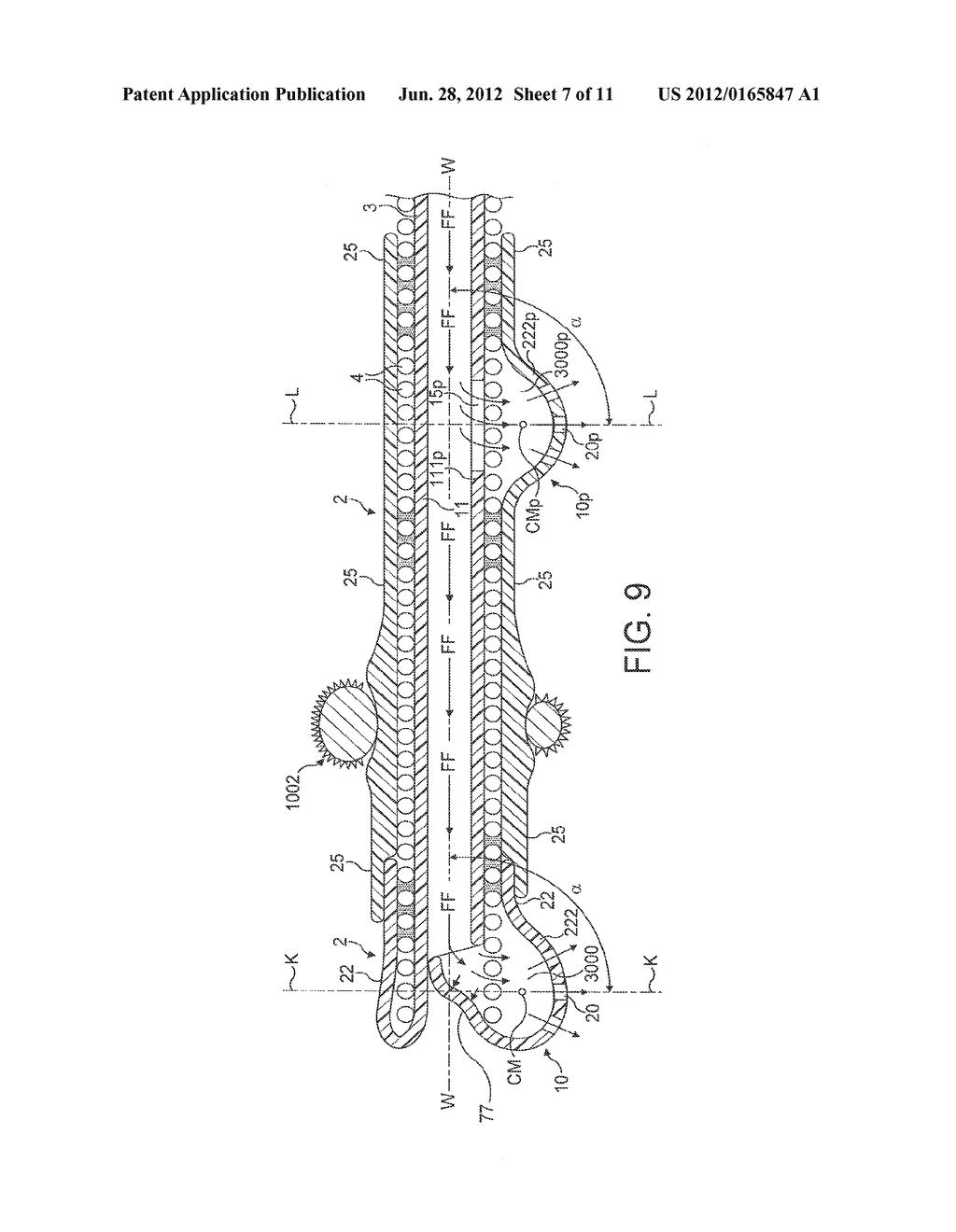 Rotational Atherectomy Device with Fluid Inflatable Support Elements     Supported by Fluid Bearings - diagram, schematic, and image 08