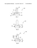 System and method for treating cartilage diagram and image