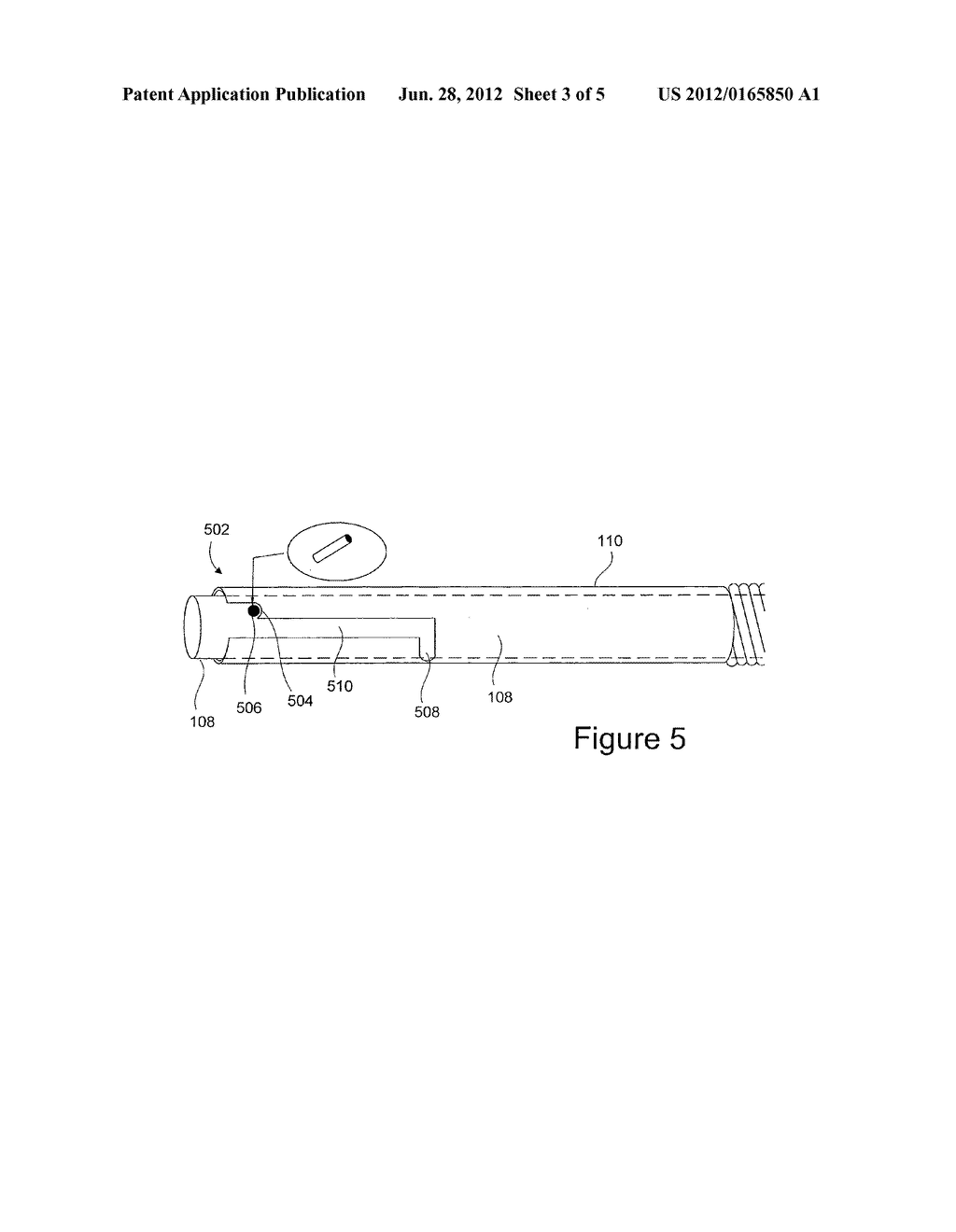 Spring Action Medical Device - diagram, schematic, and image 04