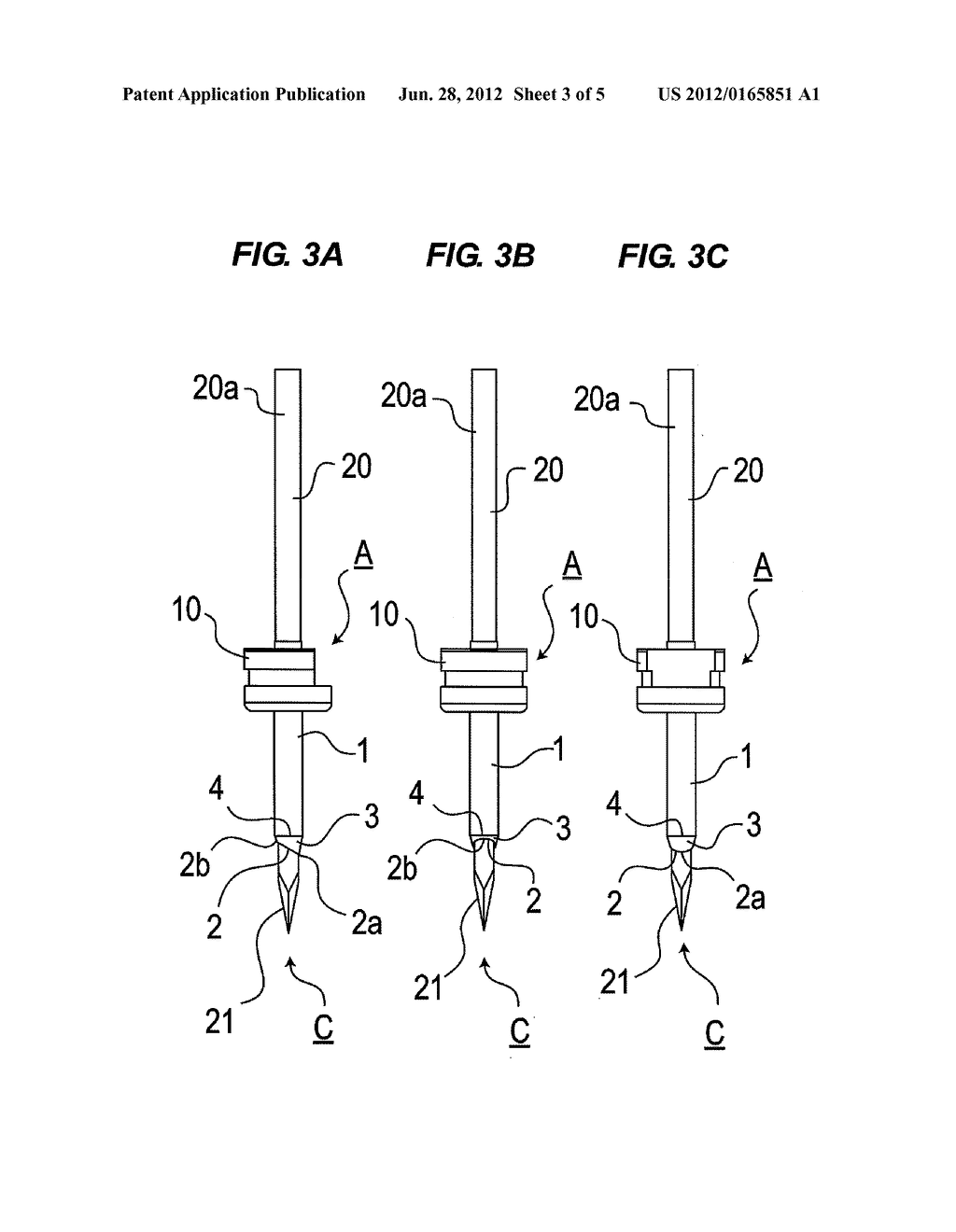 CANNULA AND METHOD OF MANUFACTURING THE CANNULA - diagram, schematic, and image 04