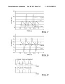 Femoral Vein Catheter for Improving Cardiac Output, Drug Delivery and     Automated CPR Optimization diagram and image