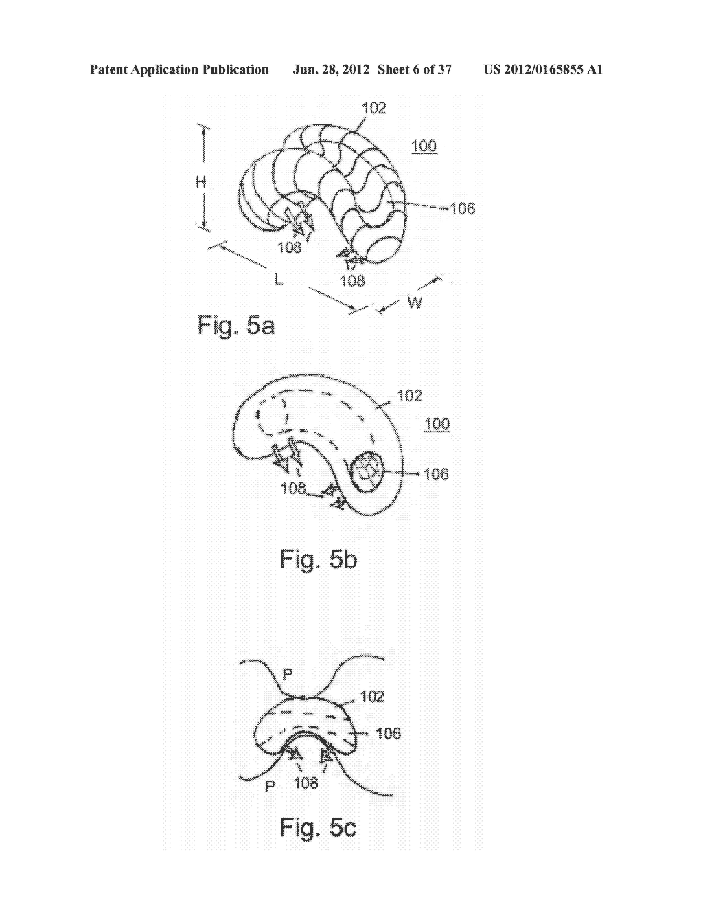 DEVICES AND METHODS FOR ALTERING EATING BEHAVIOR - diagram, schematic, and image 07