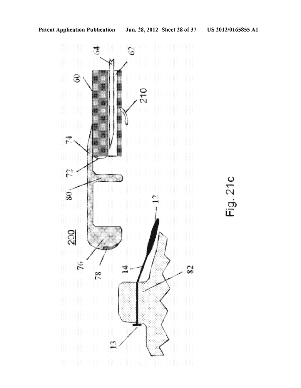 DEVICES AND METHODS FOR ALTERING EATING BEHAVIOR - diagram, schematic, and image 29