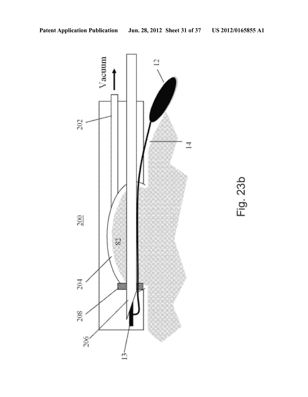 DEVICES AND METHODS FOR ALTERING EATING BEHAVIOR - diagram, schematic, and image 32