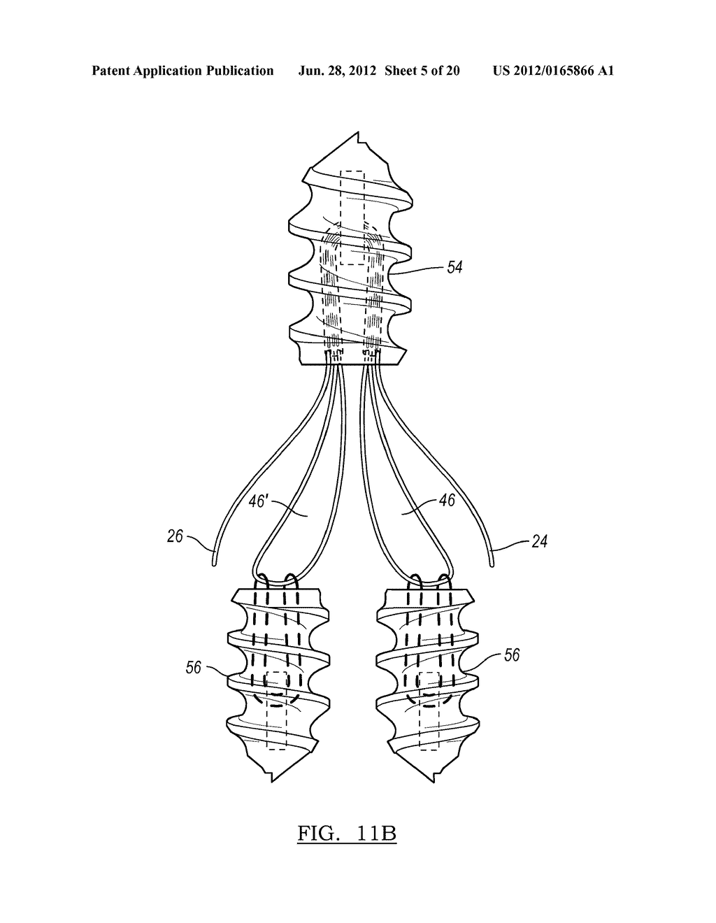 Method and Apparatus for Coupling Soft Tissue to Bone - diagram, schematic, and image 06