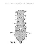 DEVICES AND METHODS FOR FACILITATING CONTROLLED BONE GROWTH OR REPAIR diagram and image