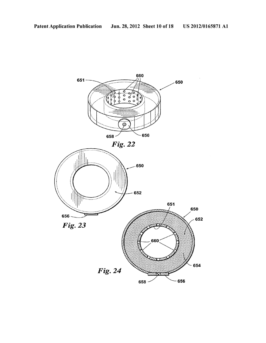 DEVICES AND METHODS FOR FACILITATING CONTROLLED BONE GROWTH OR REPAIR - diagram, schematic, and image 11