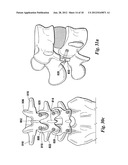 DEVICES AND METHODS FOR FACILITATING CONTROLLED BONE GROWTH OR REPAIR diagram and image