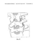 DEVICES AND METHODS FOR FACILITATING CONTROLLED BONE GROWTH OR REPAIR diagram and image