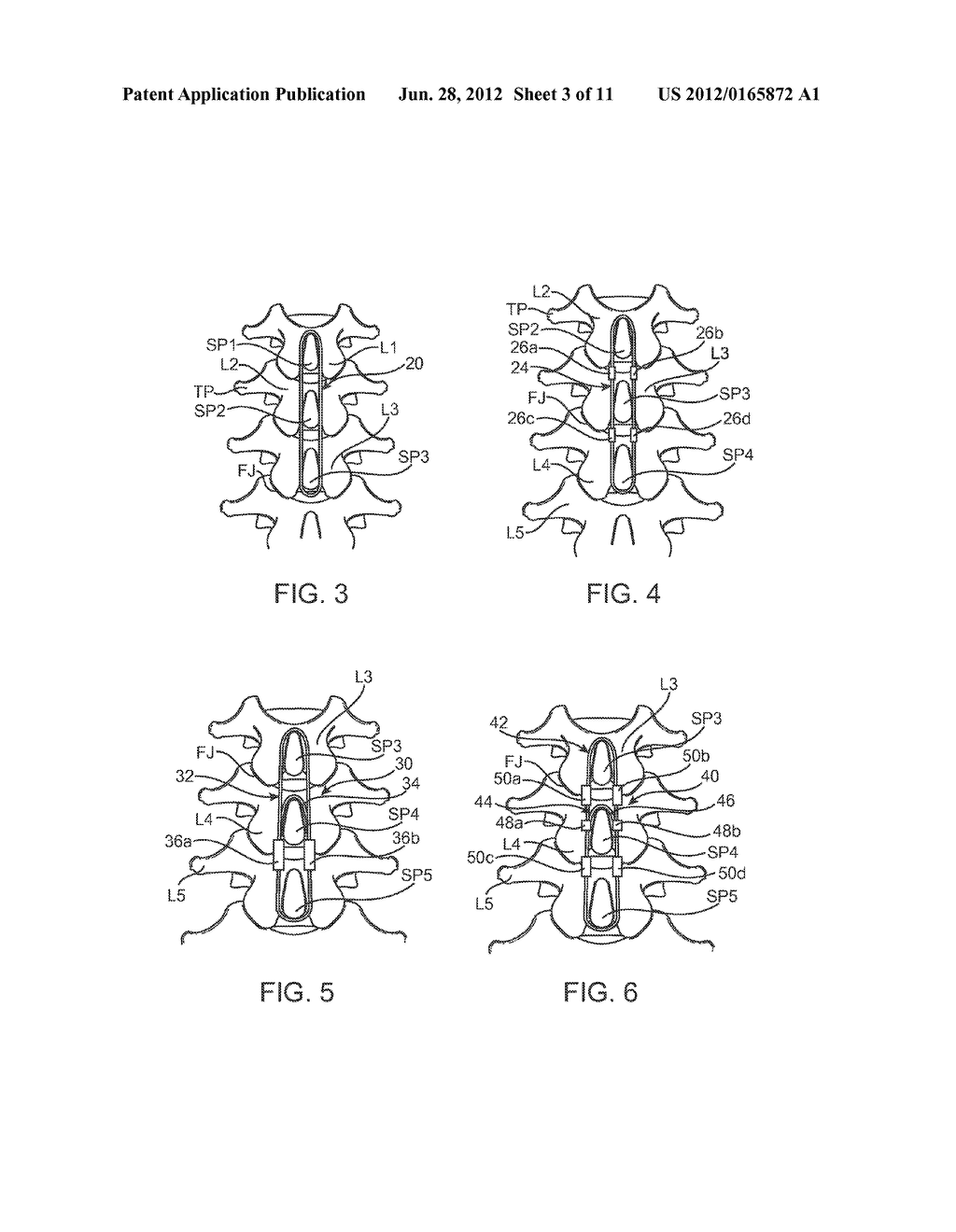 METHODS AND SYSTEMS FOR CONSTRAINT OF MULTIPLE SPINE SEGMENTS - diagram, schematic, and image 04