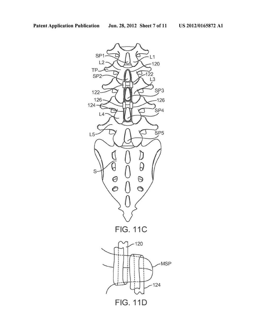 METHODS AND SYSTEMS FOR CONSTRAINT OF MULTIPLE SPINE SEGMENTS - diagram, schematic, and image 08