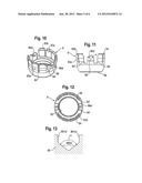 STABILIZATION DEVICE FOR STABILIZING VERTEBRAE OR BONE PARTS diagram and image