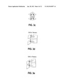 Method For Stabilizing A Spine diagram and image