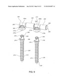 Method For Stabilizing A Spine diagram and image