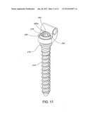 Method For Stabilizing A Spine diagram and image