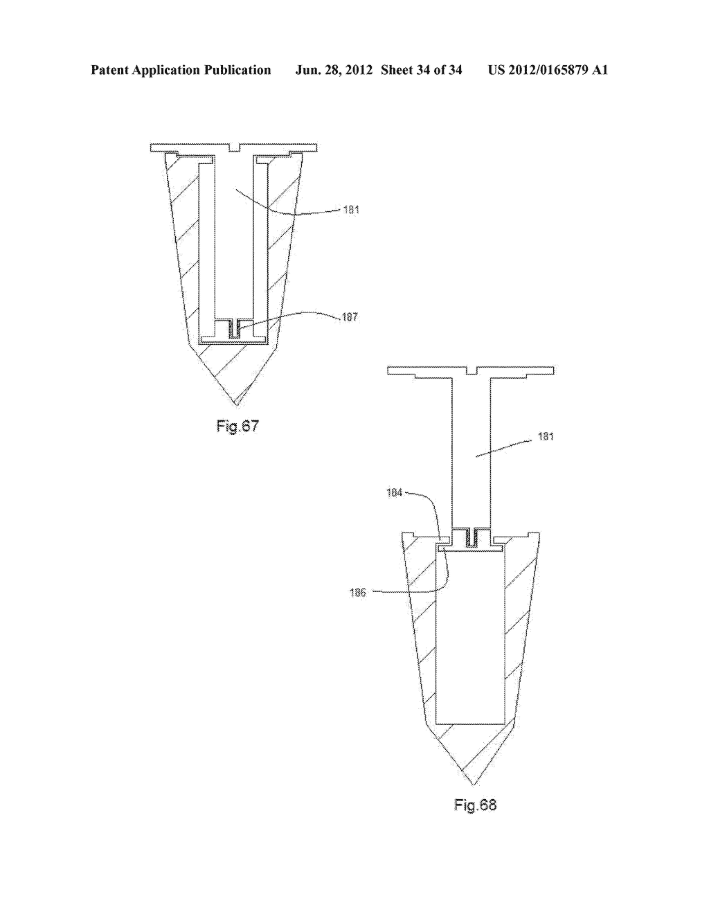 Telescopic cranial bone screw - diagram, schematic, and image 35