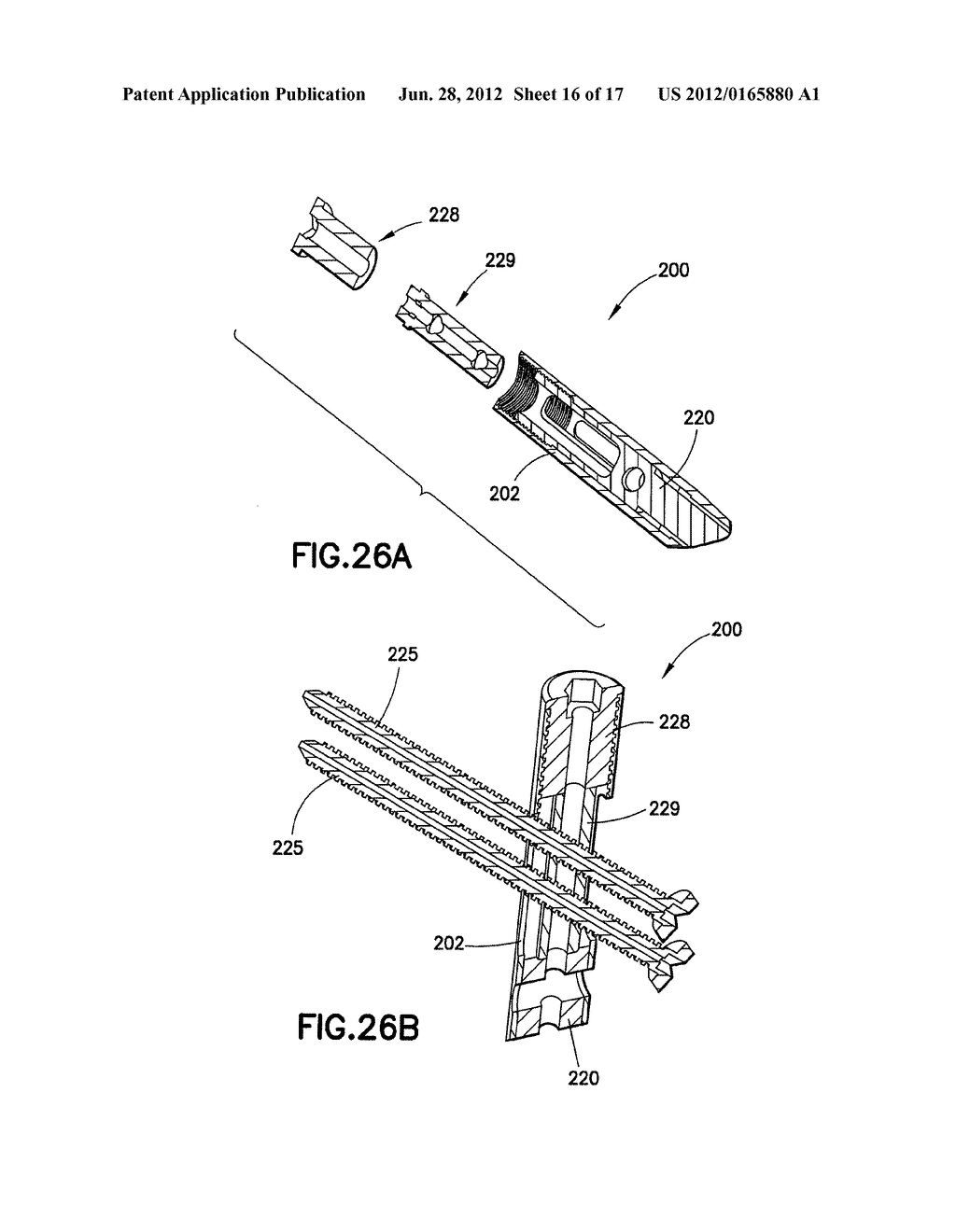 BONE FRACTURE TREATMENT DEVICES AND METHODS OF THEIR USE - diagram, schematic, and image 17