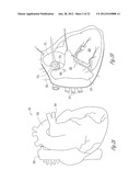 BAROREFLEX STIMULATION SYNCHRONIZED TO CIRCADIAN RHYTHM diagram and image