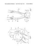 BAROREFLEX STIMULATION SYNCHRONIZED TO CIRCADIAN RHYTHM diagram and image