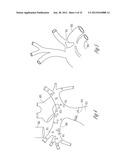 BAROREFLEX STIMULATION SYNCHRONIZED TO CIRCADIAN RHYTHM diagram and image