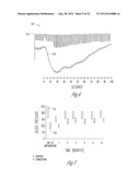 BAROREFLEX STIMULATION SYNCHRONIZED TO CIRCADIAN RHYTHM diagram and image