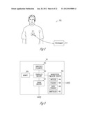 BAROREFLEX STIMULATION SYNCHRONIZED TO CIRCADIAN RHYTHM diagram and image