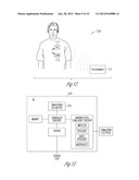 BAROREFLEX STIMULATION SYNCHRONIZED TO CIRCADIAN RHYTHM diagram and image