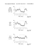 BAROREFLEX STIMULATION SYNCHRONIZED TO CIRCADIAN RHYTHM diagram and image