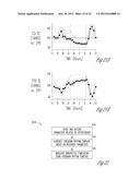 BAROREFLEX STIMULATION SYNCHRONIZED TO CIRCADIAN RHYTHM diagram and image