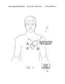 SYSTEMS AND METHODS FOR OPTIMIZING AV/VV PACING DELAYS USING COMBINED     IEGM/IMPEDANCE-BASED TECHNIQUES FOR USE WITH IMPLANTABLE MEDICAL DEVICES diagram and image