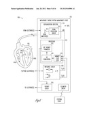 CLOSED LOOP IMPEDANCE-BASED CARDIAC RESYNCHRONIZATION THERAPY SYSTEMS,     DEVICES, AND METHODS diagram and image