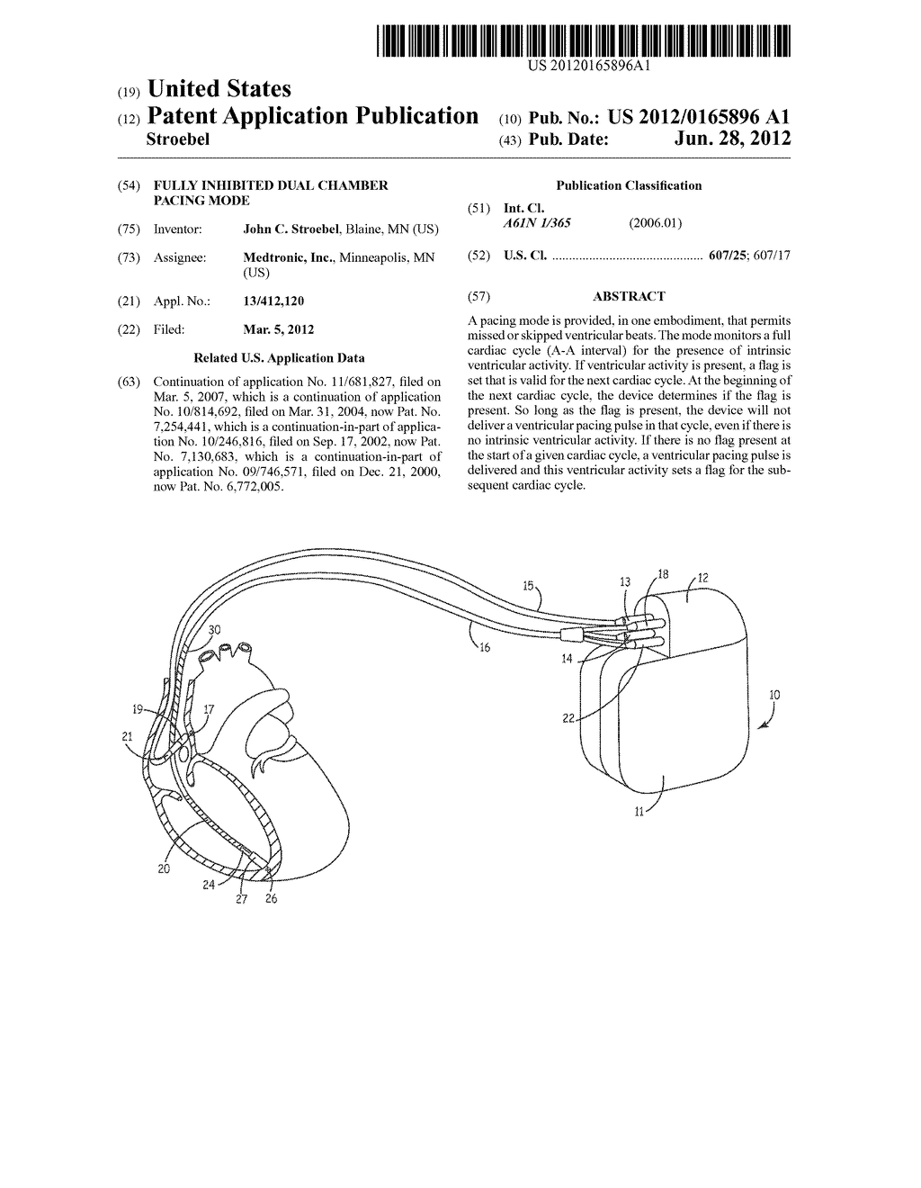 FULLY INHIBITED DUAL CHAMBER PACING MODE - diagram, schematic, and image 01