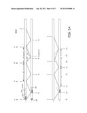 FULLY INHIBITED DUAL CHAMBER PACING MODE diagram and image