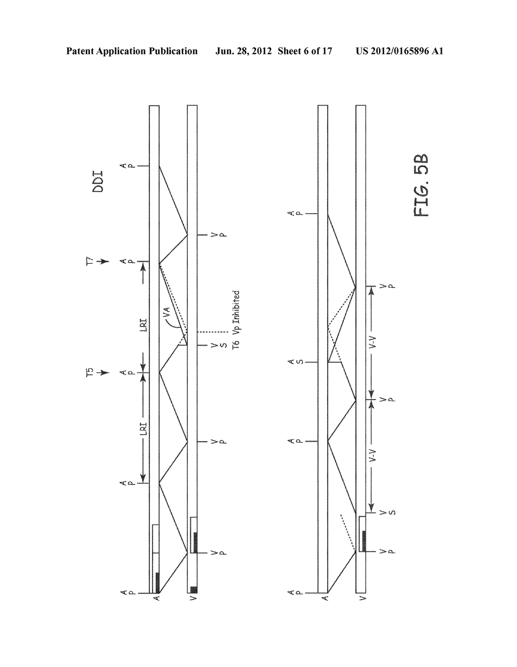 FULLY INHIBITED DUAL CHAMBER PACING MODE - diagram, schematic, and image 07