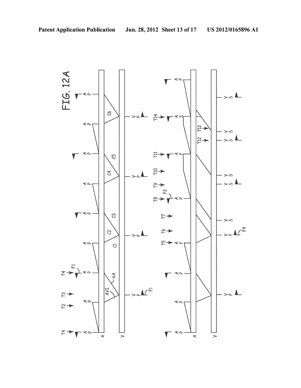 FULLY INHIBITED DUAL CHAMBER PACING MODE - diagram, schematic, and image 14